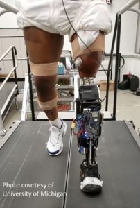 Person with prosthetic on treadmill 